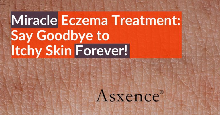 Eczema Treatment